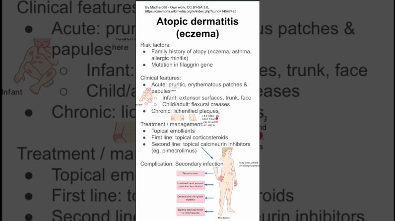 1766180584 maxresdefault