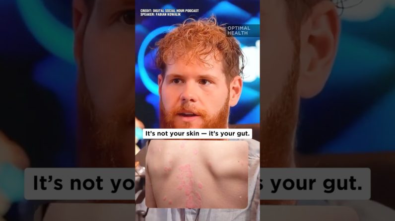 1766181787 maxresdefault