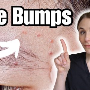 1766184057 maxresdefault