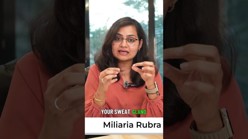 1766185459 maxresdefault