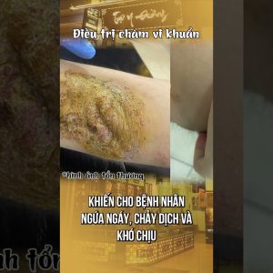 1766195045 maxresdefault