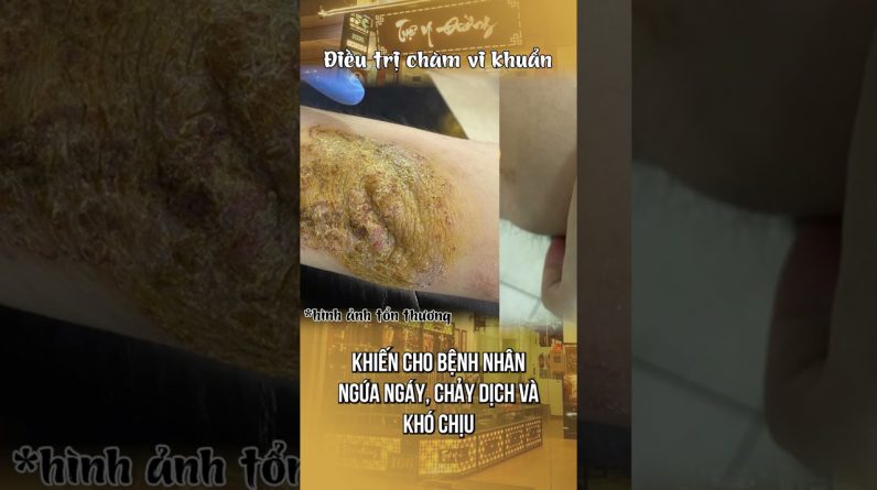 1766195045 maxresdefault