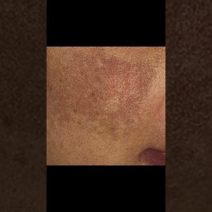 1766198686 maxresdefault