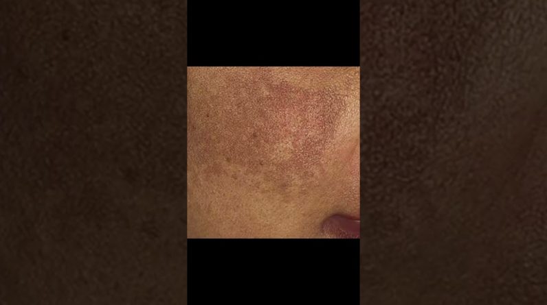 1766198686 maxresdefault