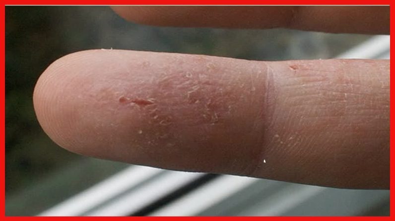 1766202372 maxresdefault