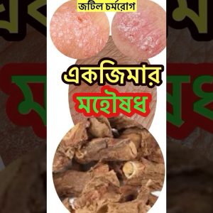 1766204108 maxresdefault