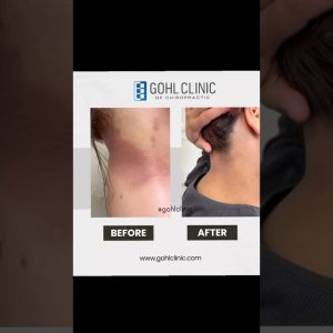 1766206220 maxresdefault