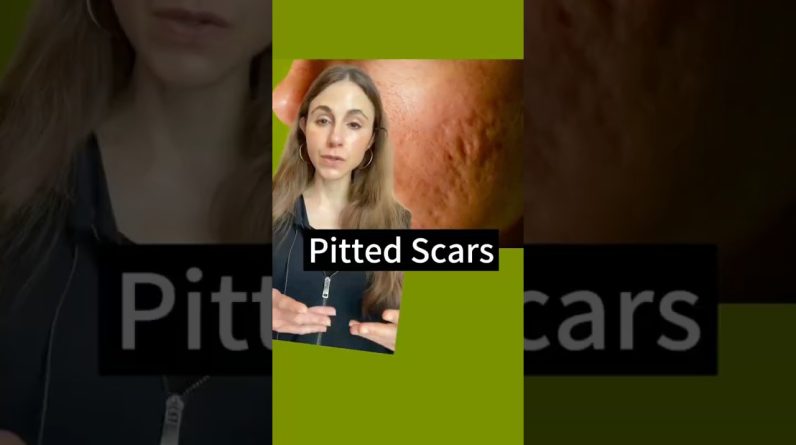 1766209691 maxresdefault