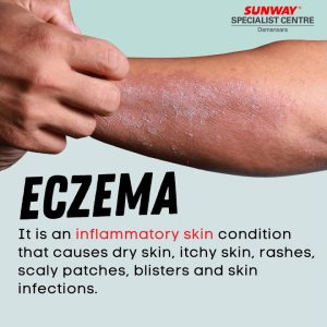 1766209859 maxresdefault