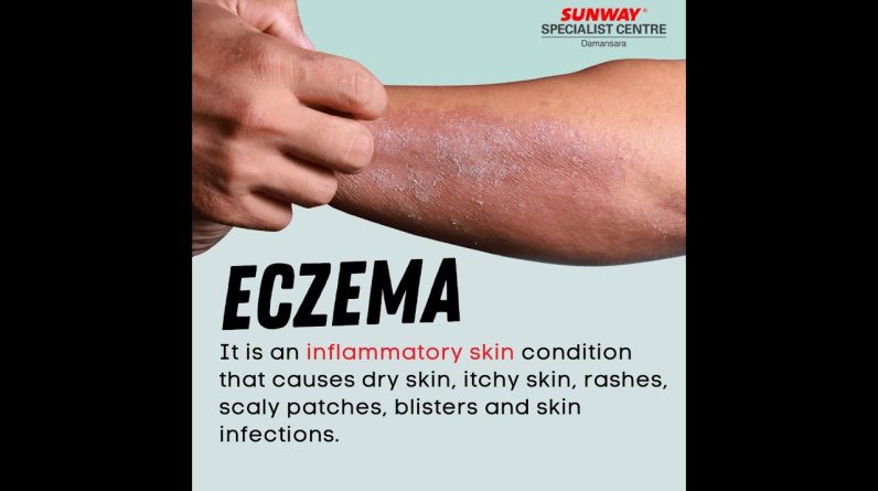 1766209859 maxresdefault