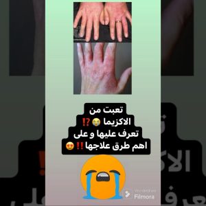 1766215127 maxresdefault