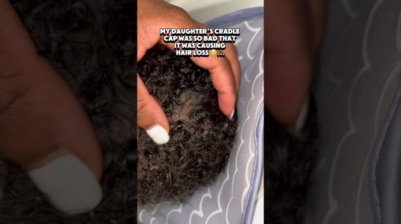 1766232652 maxresdefault