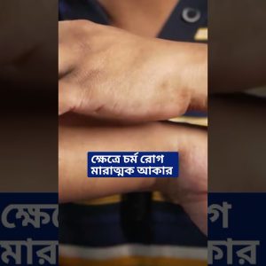 1766237093 maxresdefault