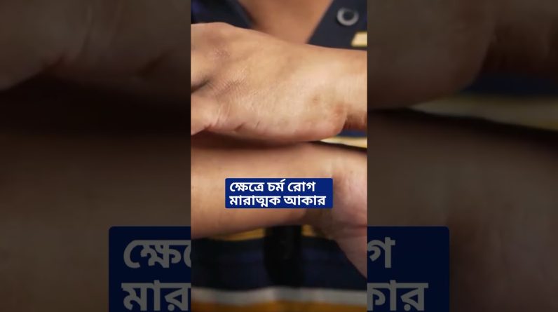 1766237093 maxresdefault