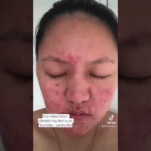 1766246227 hqdefault