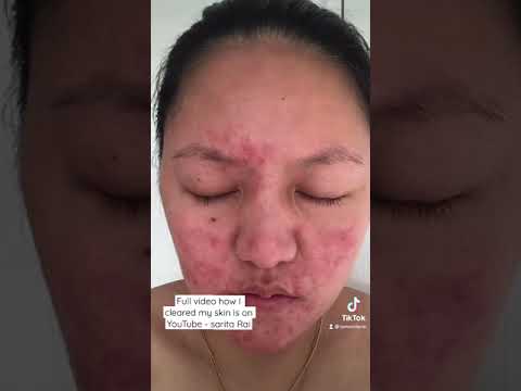 1766246227 hqdefault