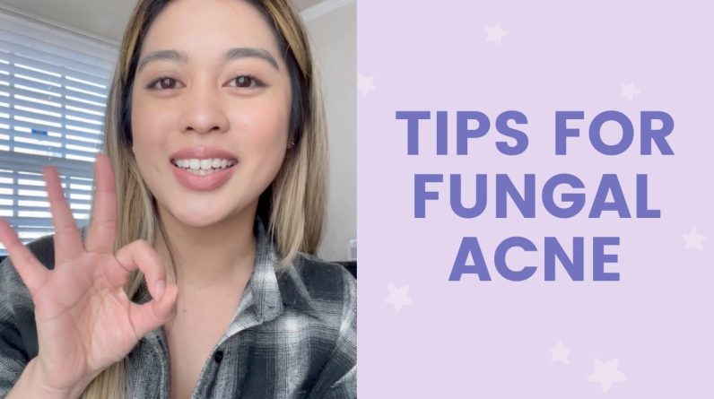 1766254908 maxresdefault