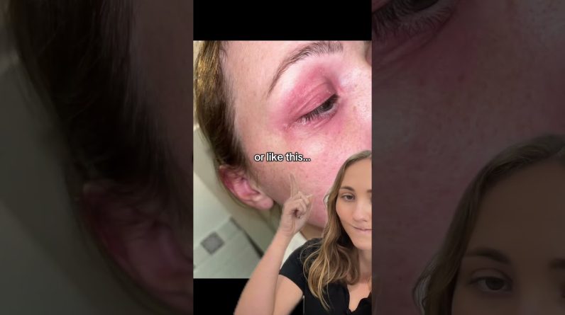 1766279084 maxresdefault