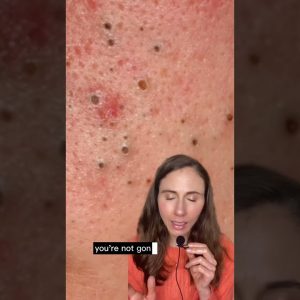 1766305244 maxresdefault