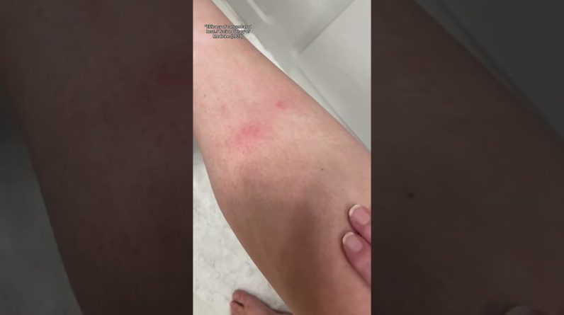 1766337719 maxresdefault