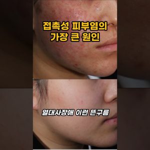 1766343011 maxresdefault