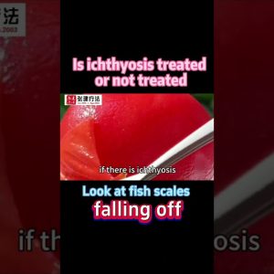 1766343428 maxresdefault