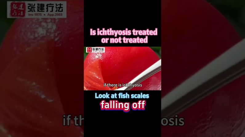 1766343428 maxresdefault