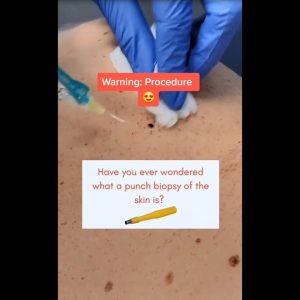 1766364645 maxresdefault