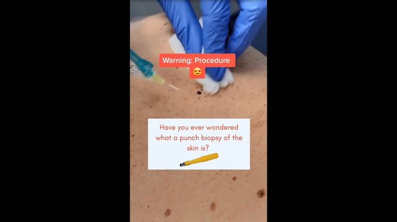 1766364645 maxresdefault