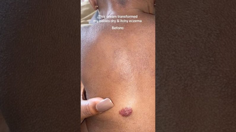 1766368313 maxresdefault