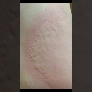 1766390927 maxresdefault