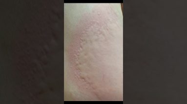 1766390927 maxresdefault