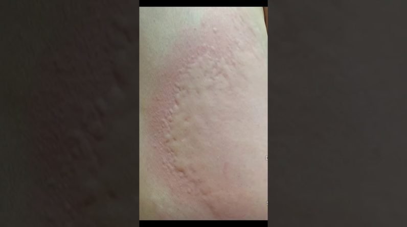 1766390927 maxresdefault