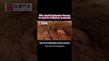 1766394603 maxresdefault