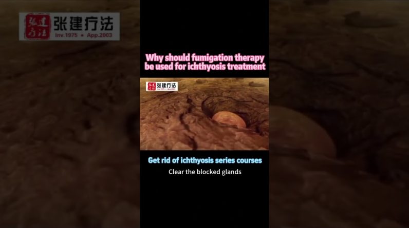 1766394603 maxresdefault