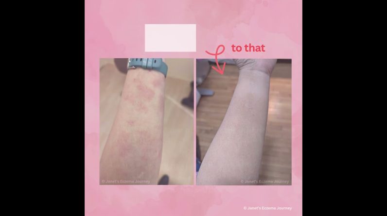 1766396810 maxresdefault