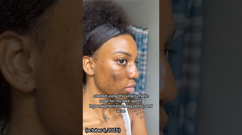 1766397713 maxresdefault