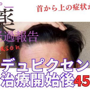 1766400230 maxresdefault