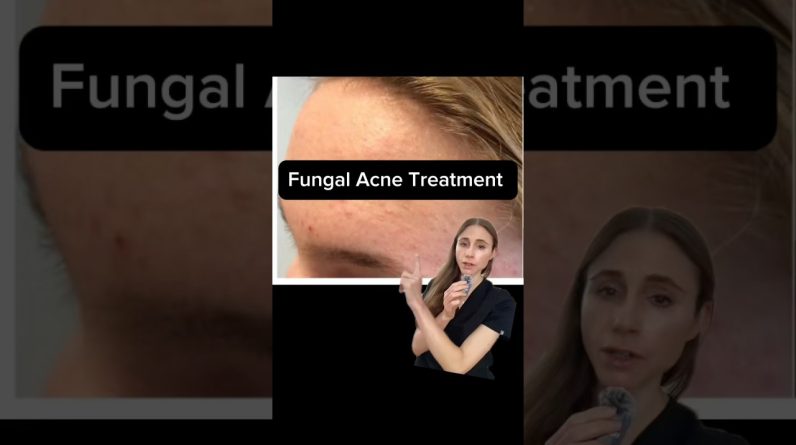 1766414566 maxresdefault