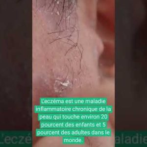 1766422497 hqdefault