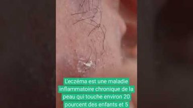 1766422497 hqdefault