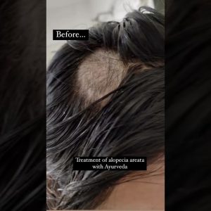 1766434210 maxresdefault