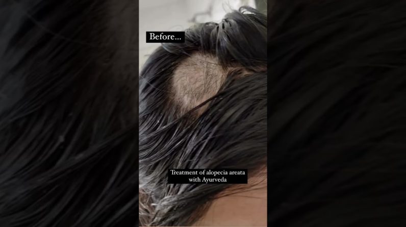 1766434210 maxresdefault