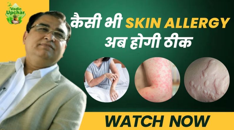 1766437848 maxresdefault