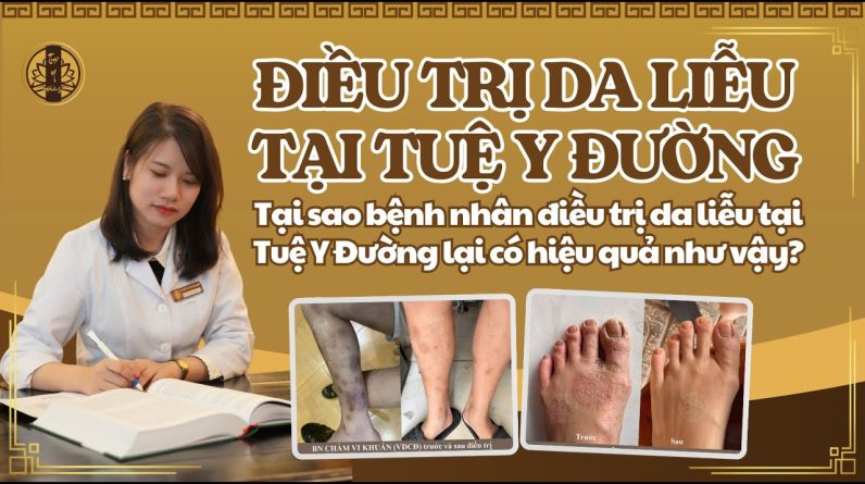 1766438278 maxresdefault