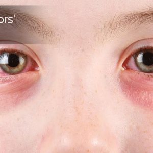 1766478108 maxresdefault