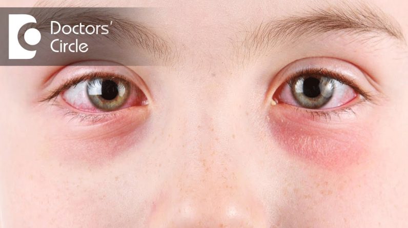 1766478108 maxresdefault