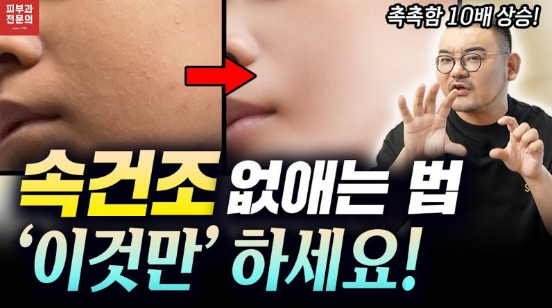 1766485865 maxresdefault