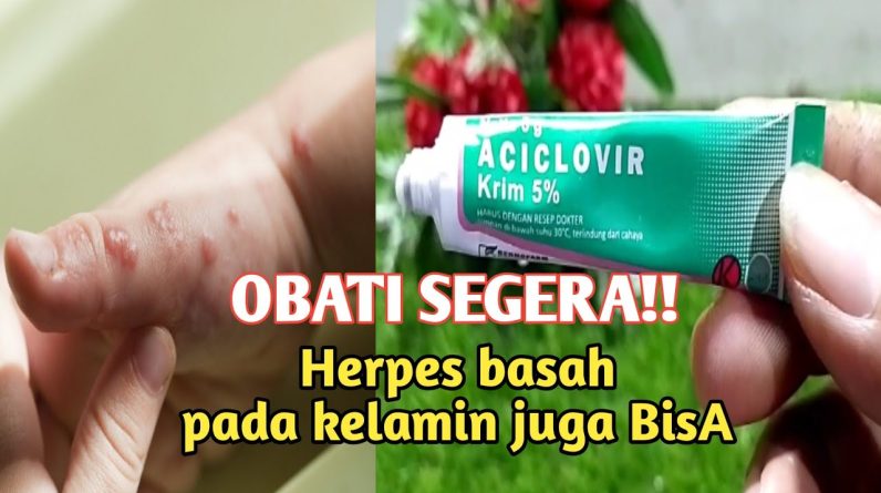 1766491706 maxresdefault