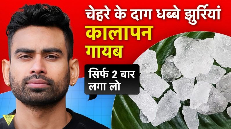 1766500282 maxresdefault